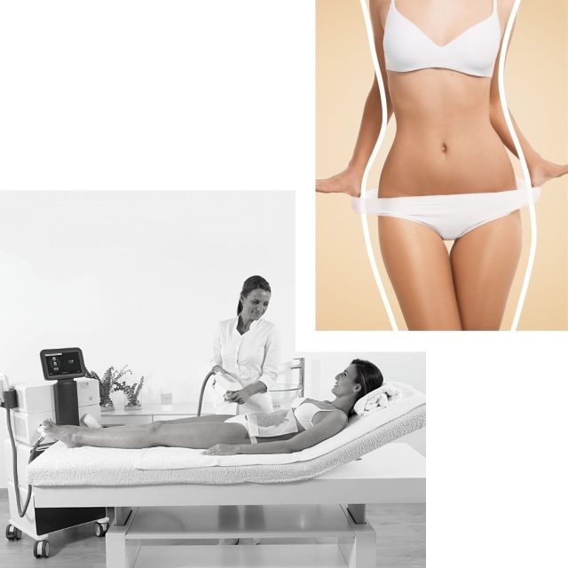 criocuum criolipolisis edenxia